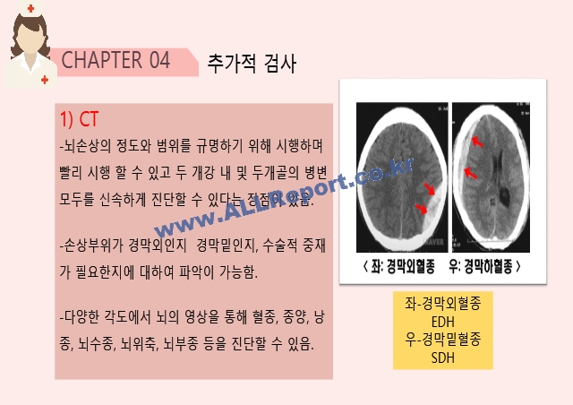 성인간호학 두개저골절 사례분석 PPT자료 [간호진단 및 간호과정 3개]   (10 )