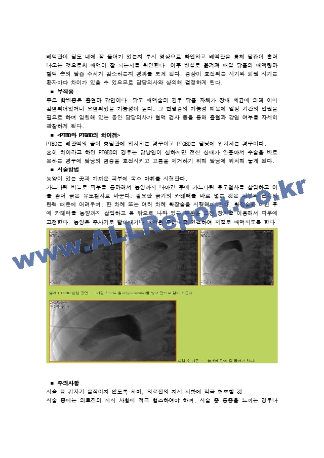 급성 담낭염 문헌고찰.hwp