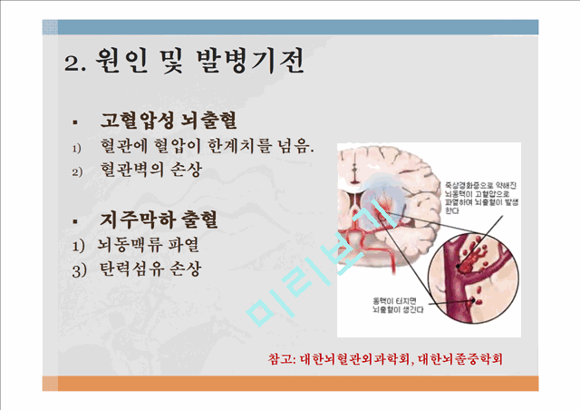 뇌혈관질환 정의 및 현황,뇌혈관질환 원인 및 발병기전,뇌졸중(Stroke), 중풍,고혈압성 뇌출혈,뇌경색,중풍예방,뇌졸증 예방및 처방.pptx