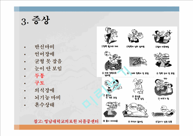 뇌혈관질환 정의 및 현황,뇌혈관질환 원인 및 발병기전,뇌졸중(Stroke), 중풍,고혈압성 뇌출혈,뇌경색,중풍예방,뇌졸증 예방및 처방.pptx