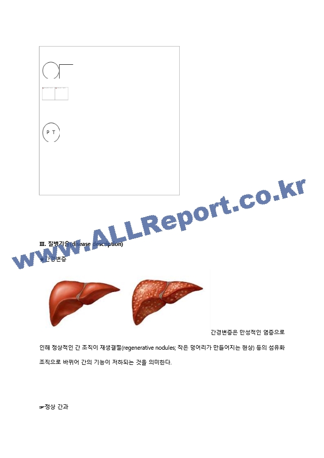 성인케이스-간경변증.hwp