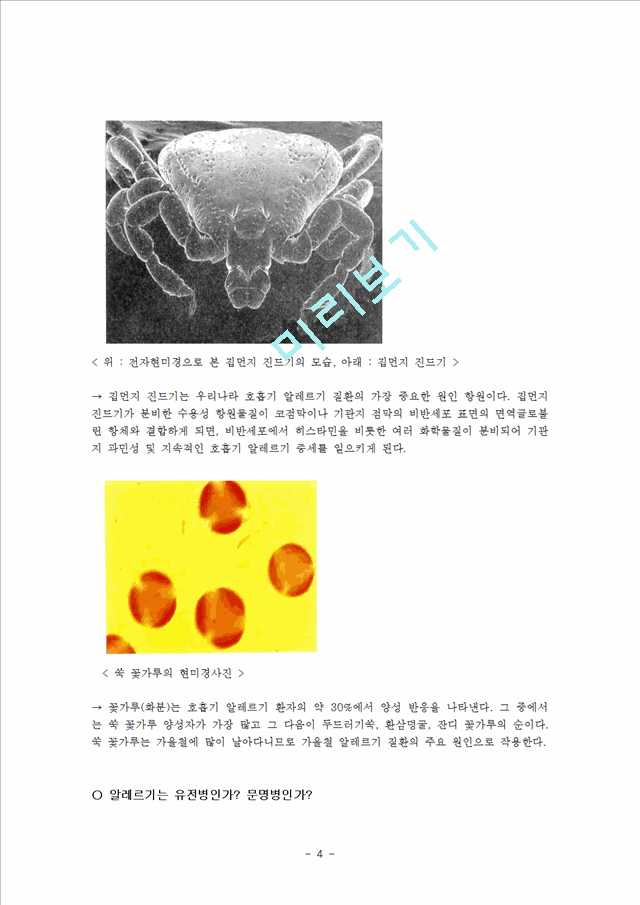 알레르기의 정의 및 원인.hwp