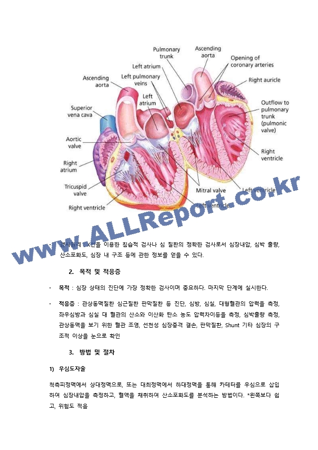 주제발표 심전도.docx