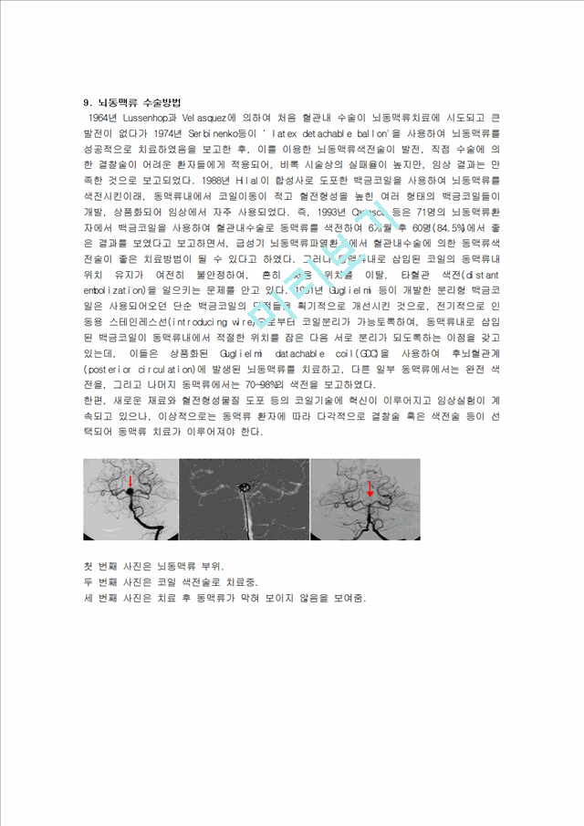 지주막하출혈 간호사정.hwp