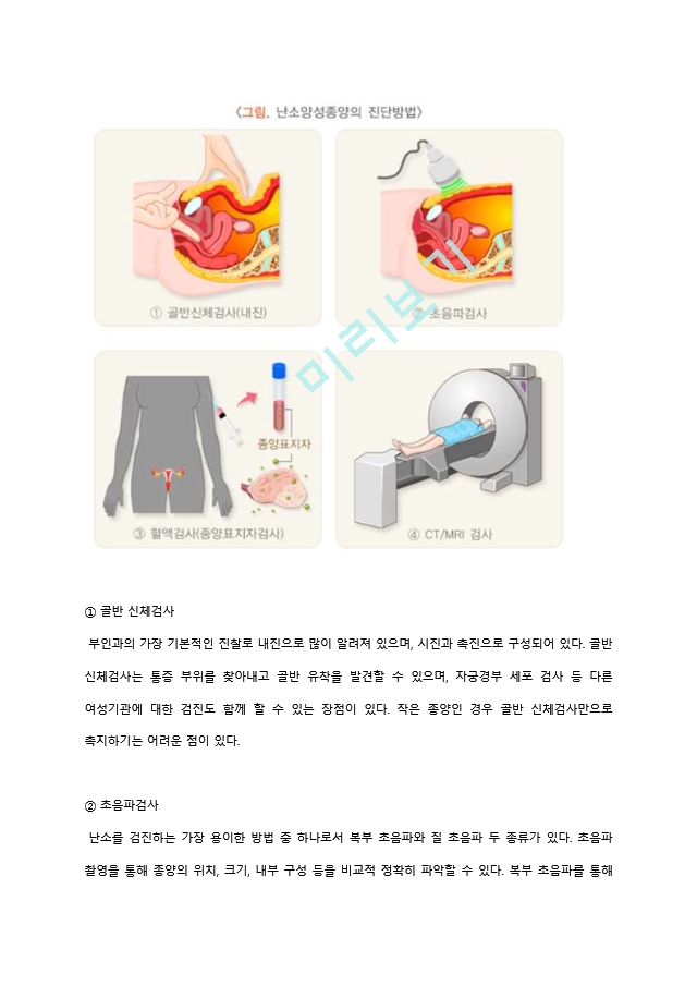 케이스스터디 benign ovary tumor.hwp