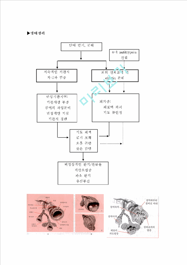 페쇄성폐질환.hwp