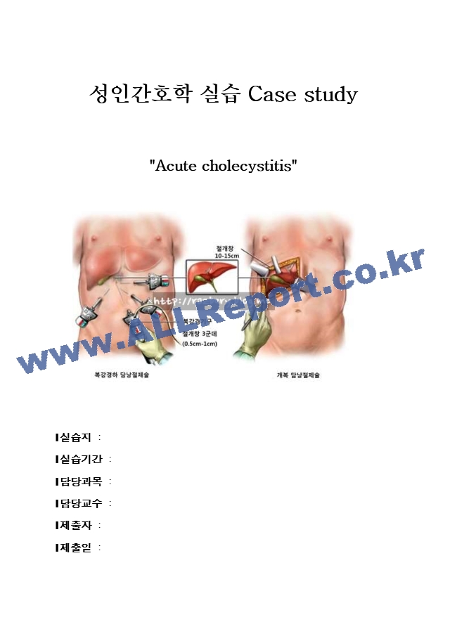 Acute cholecystitis Case study (이미지 포함), 간호진단,과정 각각 2개씩.hwp